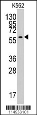 YARS2 Antibody