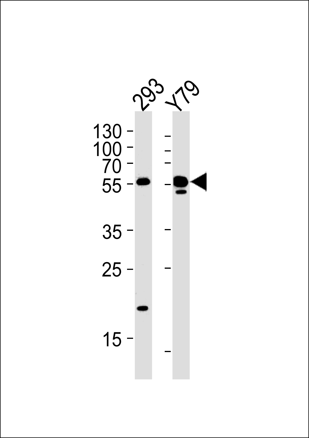 ALDH1A3 Antibody