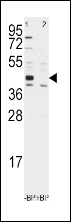 ALDH1A3 Antibody