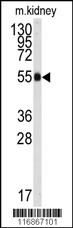 ALDH9A1 Antibody