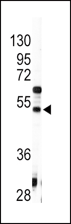 AGT Antibody