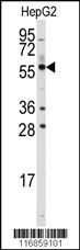 ALDH4A1 Antibody