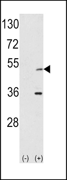 AIK Antibody