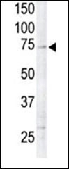 RSK4 Antibody