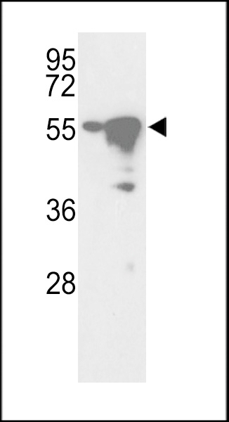 YSK Antibody
