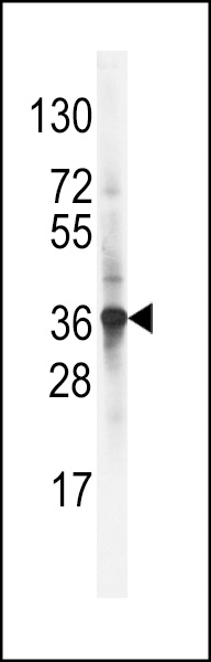 ARH Antibody