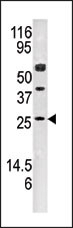AK3 Antibody