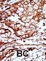 YWHAB Antibody