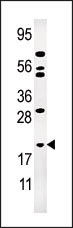 AK1 Antibody
