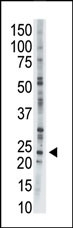 AK1 Antibody