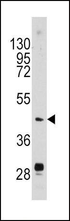 Urokinase Antibody