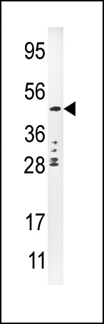 Urokinase Antibody
