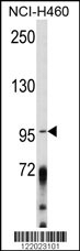 AKAP3 Antibody