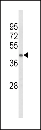 ACADL Antibody