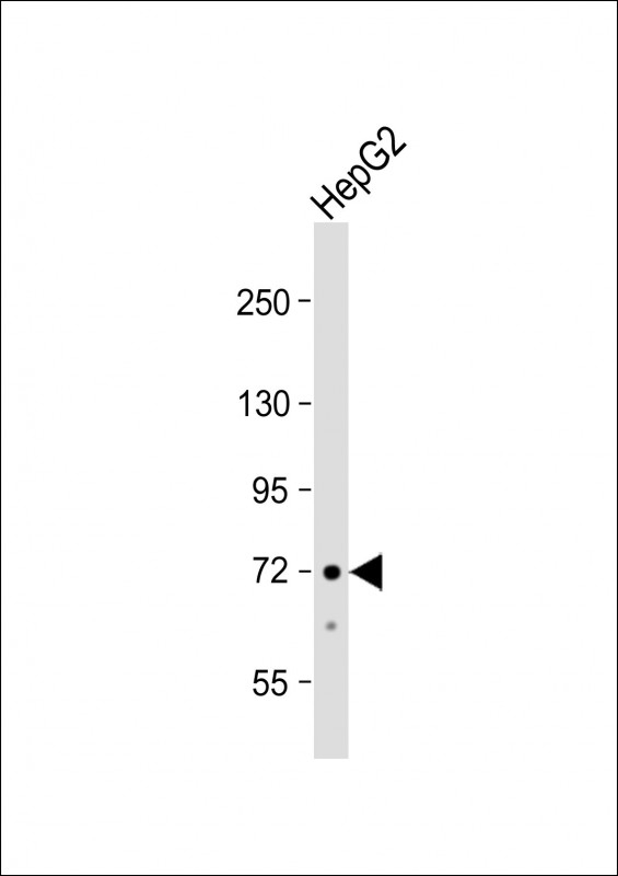 ACSS3 Antibody