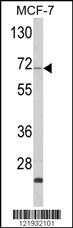 ZYG11A Antibody
