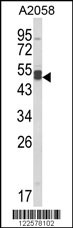 AGPAT3 Antibody