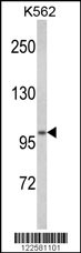 ATP12A Antibody