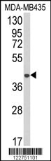 AGPAT4 Antibody