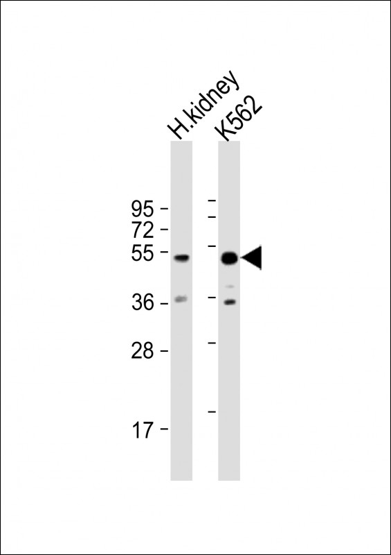 ALDH3B1 Antibody