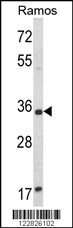 ACY3 Antibody
