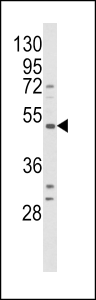 BDK_1 Antibody