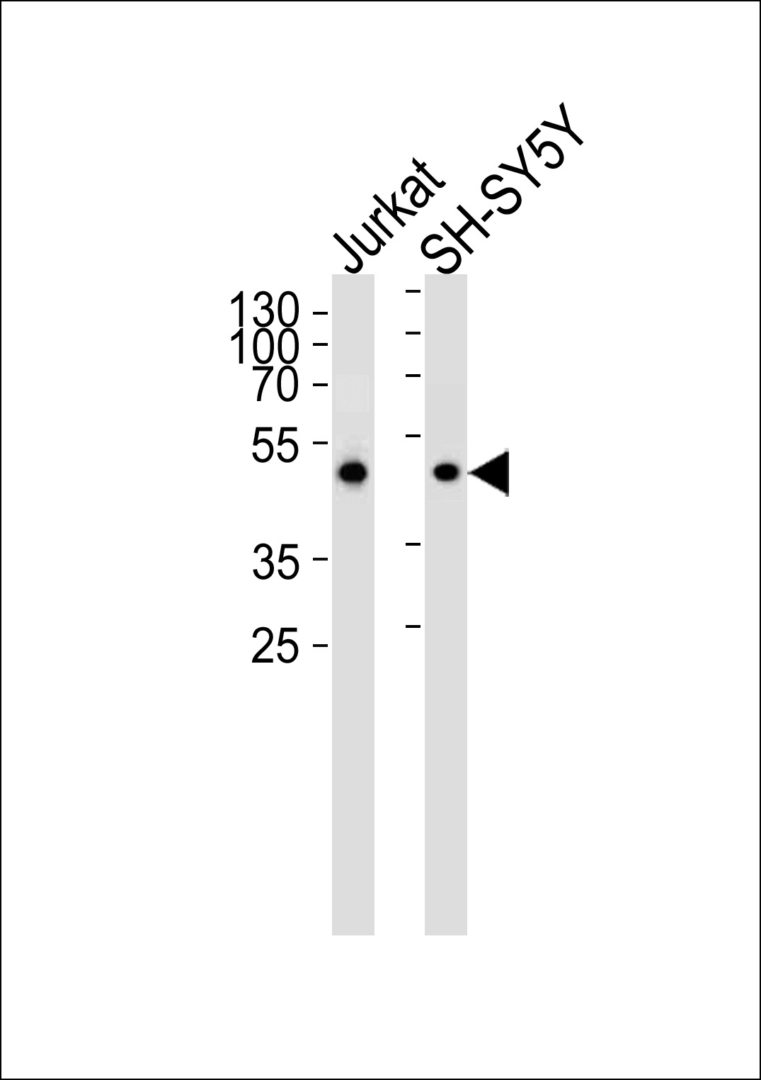 ANXA7 Antibody