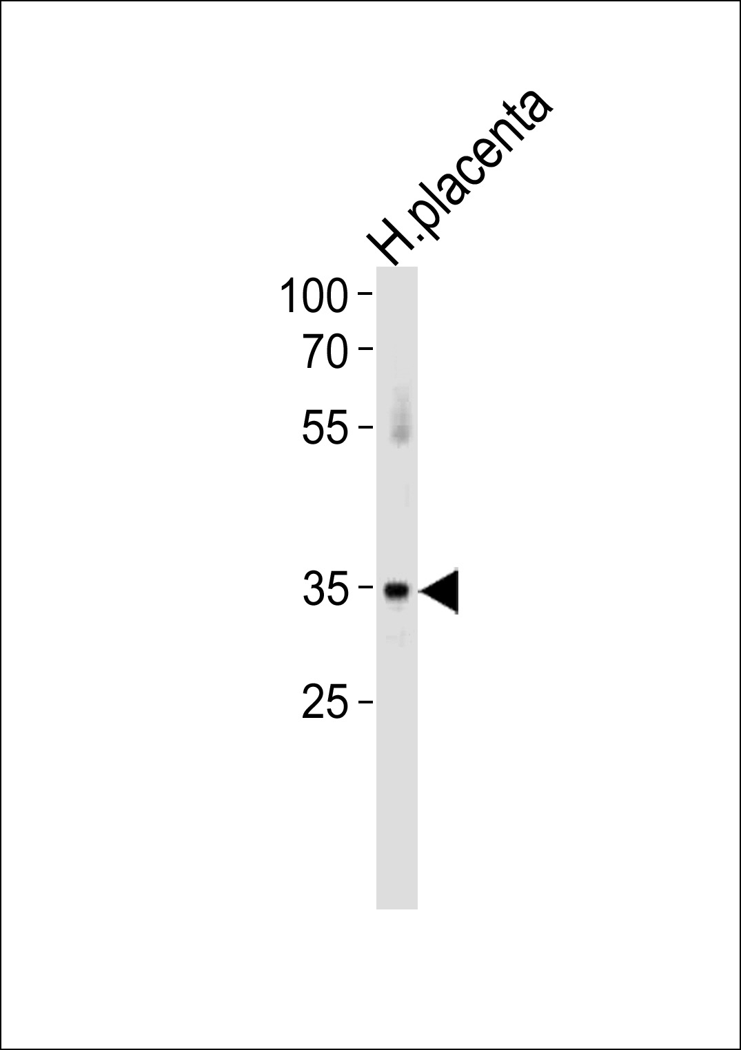 ATF7 Antibody