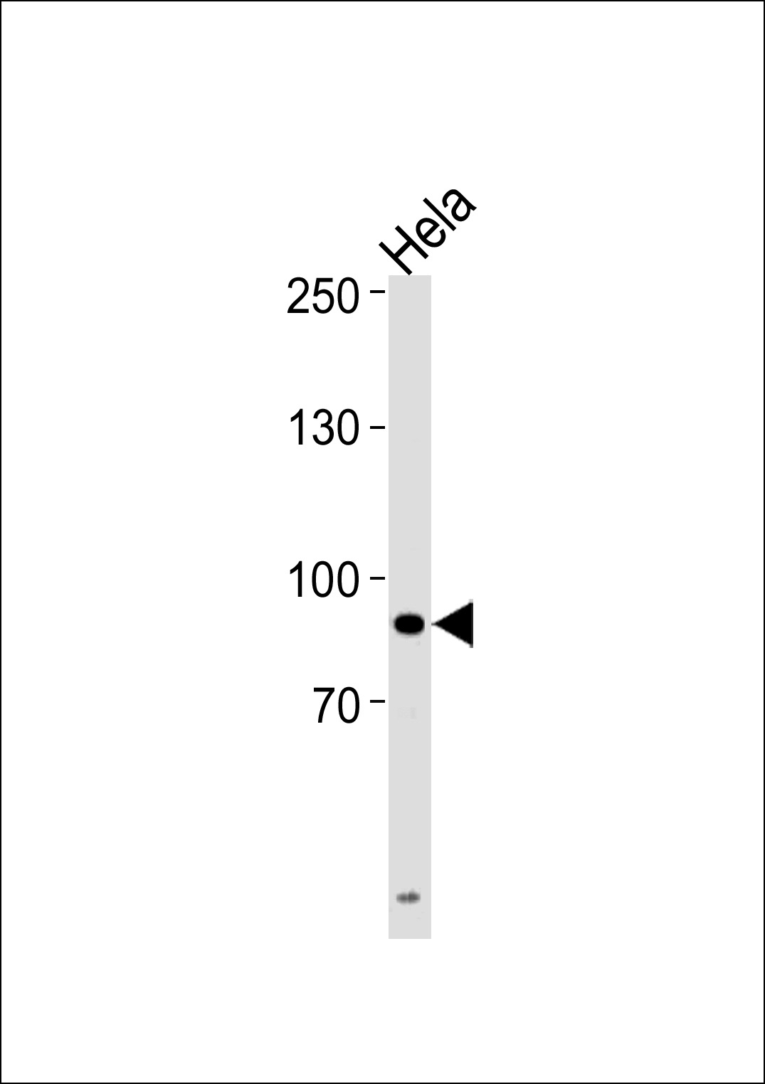 UHRF1 Antibody