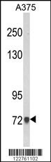 AMOTL2 Antibody
