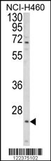ALG14 Antibody