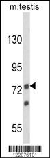 ANGEL1 Antibody