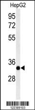 ACER3 Antibody