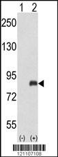 ADRBK2 Antibody
