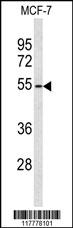 ADAMDEC1 Antibody