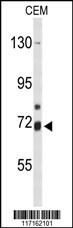 ALOX15B Antibody