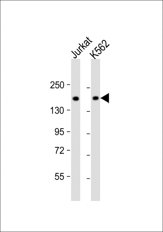 TOP2A Antibody