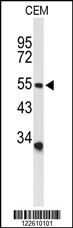 ACCN2 Antibody