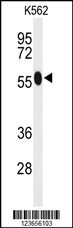 ACSM1 Antibody