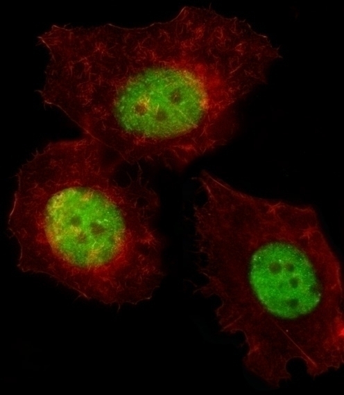 TREF1 Antibody