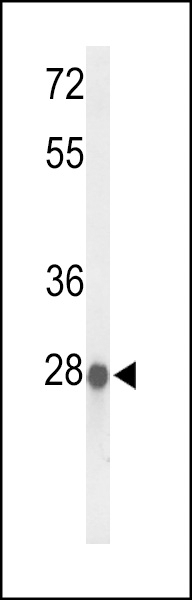 ABHDB Antibody
