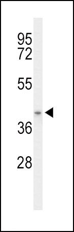 ACAD8 Antibody