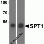 Western blot analysis of SPT1 in human lung tissue lysate with SPT1 antibody at 1 µg/mL in (A) the absence and (B) the presence of blocking peptide.
