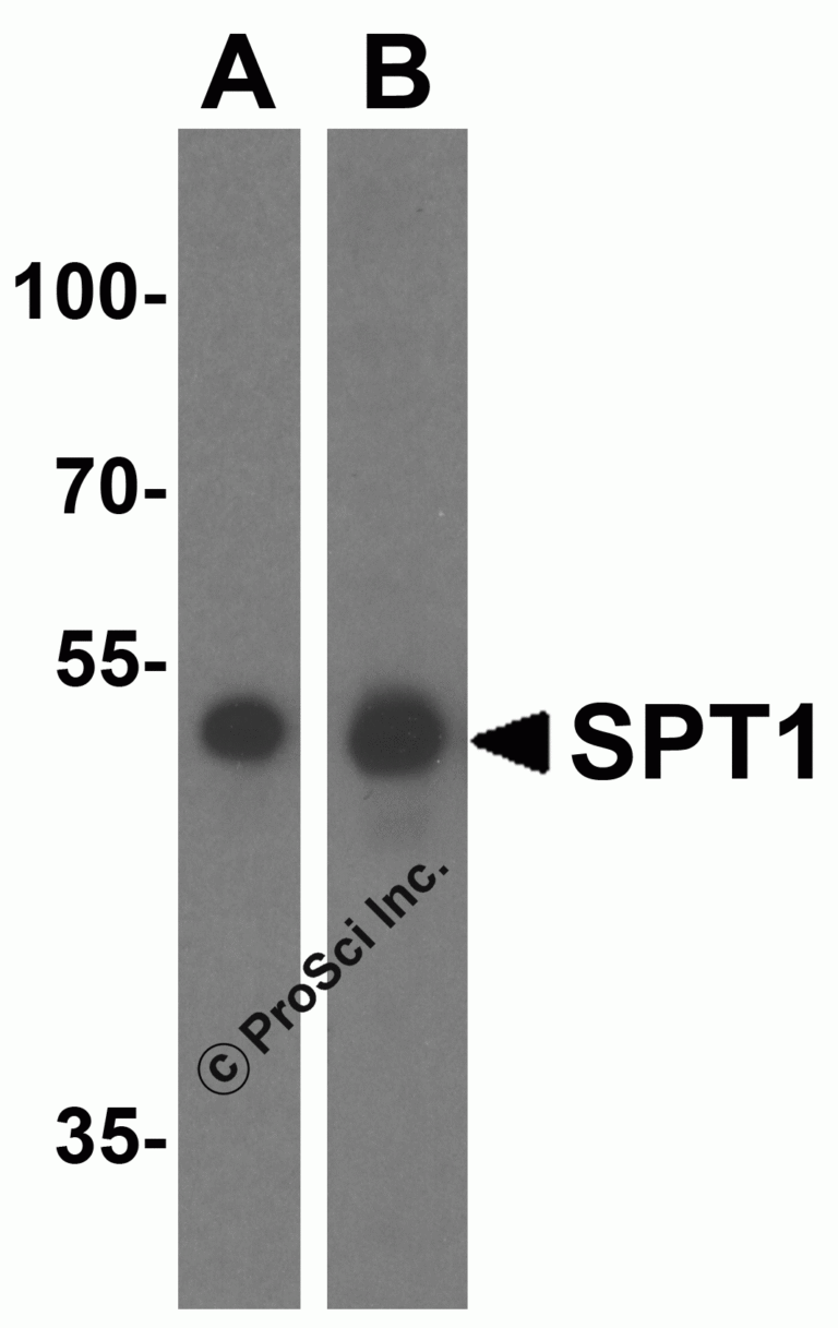 SPT1 Peptide