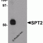 Western blot analysis of SPT2 in 3T3 cell lysate with SPT2 antibody at 1 µg/mL in (A) the absence and (B) the presence of blocking peptide.