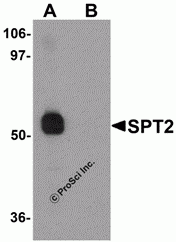 SPT2 Peptide