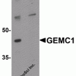 Western blot analysis of CCDC141 in SK-N-SH cell tissue lysate with CCDC141 antibody at 1 μg/mL in (A) the absence and (B) the presence of blocking peptide.