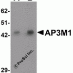 Western blot analysis of SPRYD3 in human brain tissue lysate with SPRYD3 antibody at 1 μg/mL in (A) the absence and (B) the presence of blocking peptide.