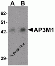 AP3M1 Peptide