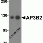 Western blot analysis of SPRYD4 in mouse kidney tissue lysate with SPRYD4 antibody at 1 μg/mL in (A) the absence and (B) the presence of blocking peptide.